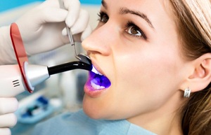 woman getting cosmetic dental bonding in Bullard