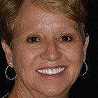 Dental patient Barbara