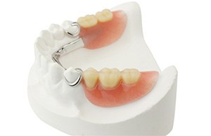Model smile with partial denture