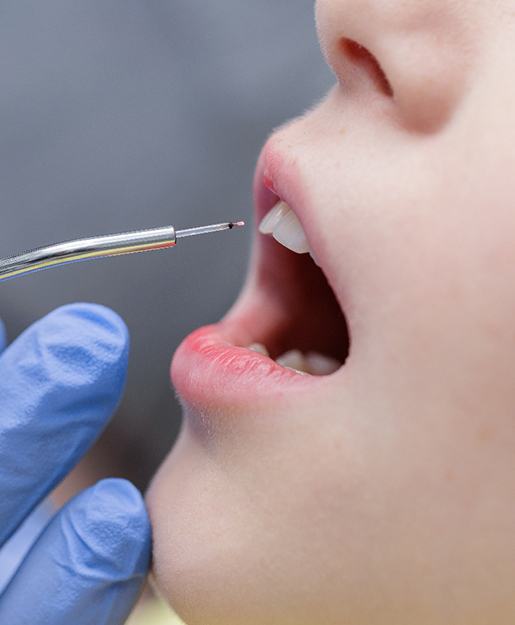 A patient getting a cosmetic gum lift