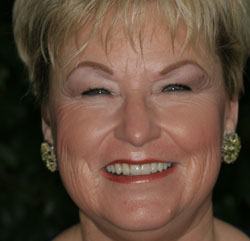 Close-up of older female patient after smile makeover