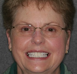 Woman with glasses and whiter smile