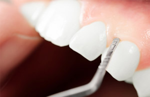 Close-up of gums