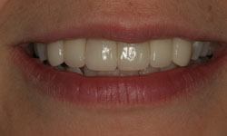 Brighter smile after dental care