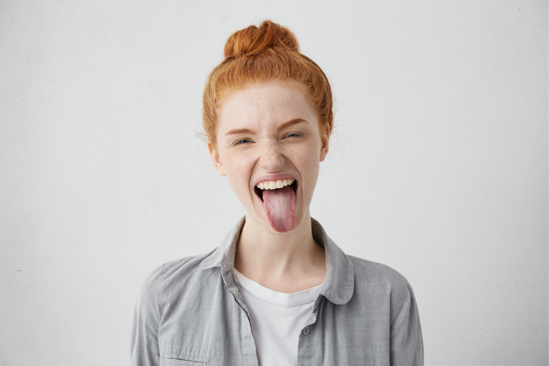 Patient sticking out tongue after removing lip & tongue-ties