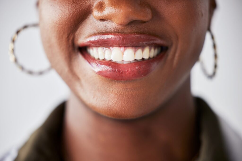 Nose-to-neck closeup of woman with beautiful teeth smiling