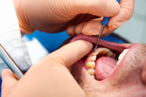 Patient receiving scaling and root planing